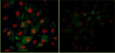 Immunocytochemistry/ Immunofluorescence: KAP1 [p Ser824] Antibody [NB100-2350]
